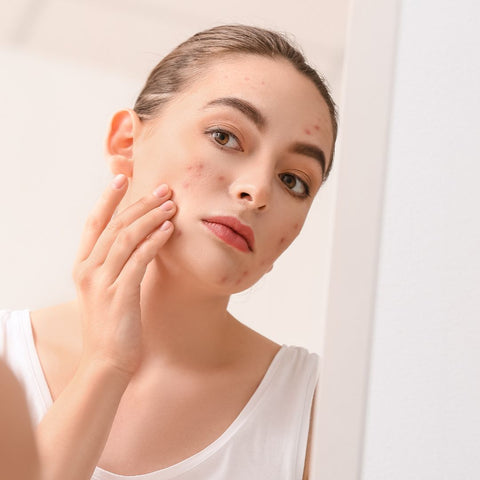 Skincare Przeciw Trądzikowi